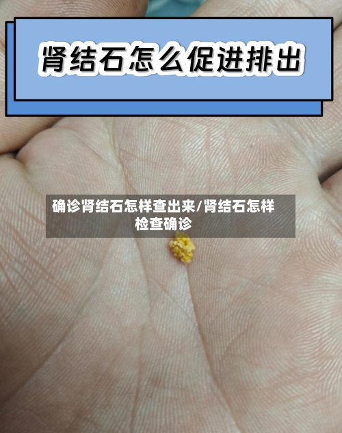 确诊肾结石怎样查出来/肾结石怎样检查确诊