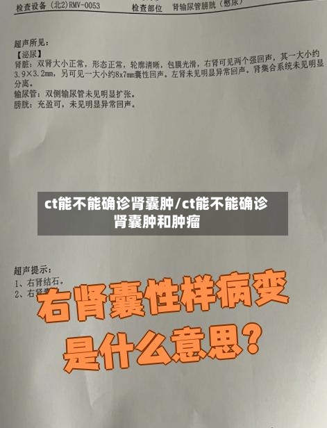 ct能不能确诊肾囊肿/ct能不能确诊肾囊肿和肿瘤-第3张图片