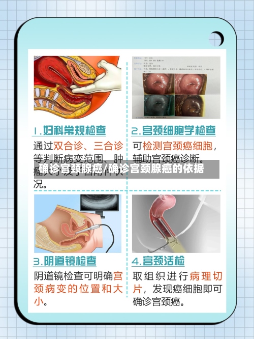 确诊宫颈腺癌/确诊宫颈腺癌的依据