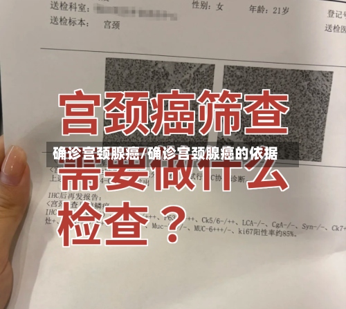 确诊宫颈腺癌/确诊宫颈腺癌的依据-第3张图片