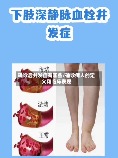 确诊后并发症有哪些/确诊病人的定义和临床表现-第2张图片