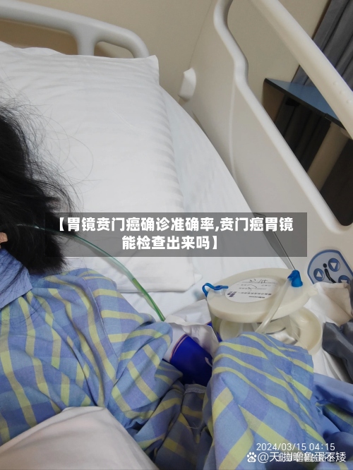 【胃镜贲门癌确诊准确率,贲门癌胃镜能检查出来吗】