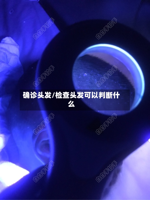 确诊头发/检查头发可以判断什么-第3张图片
