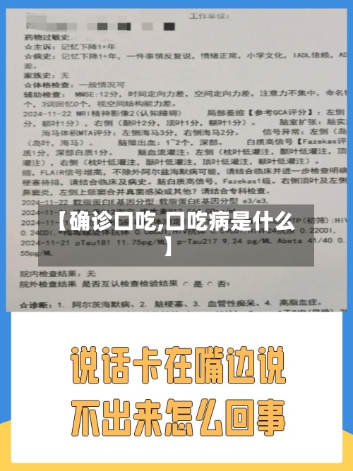 【确诊口吃,口吃病是什么】-第2张图片