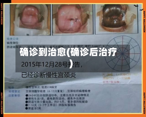 确诊到治愈(确诊后治疗)
