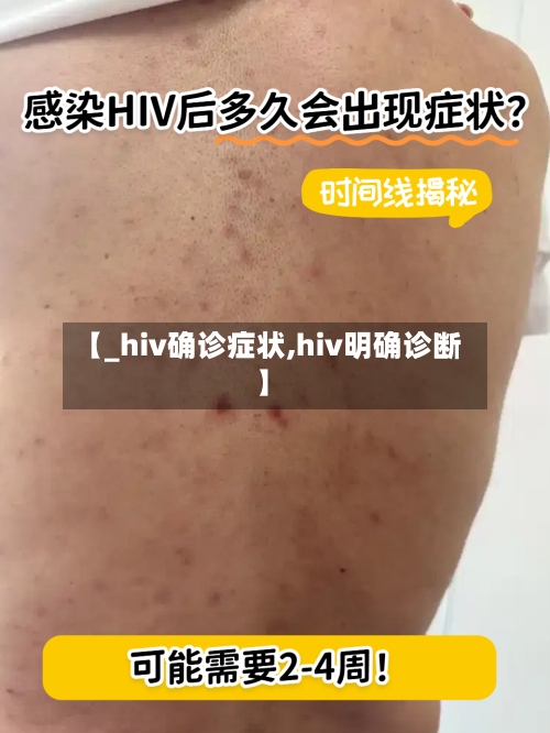 【_hiv确诊症状,hiv明确诊断】-第2张图片