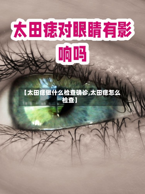 【太田痣做什么检查确诊,太田痣怎么检查】-第2张图片