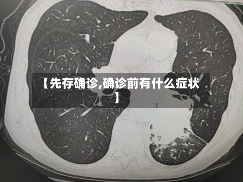 【先存确诊,确诊前有什么症状】