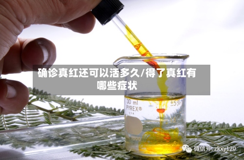 确诊真红还可以活多久/得了真红有哪些症状
