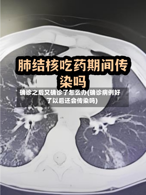 确诊之后又确诊了怎么办(确诊病例好了以后还会传染吗)