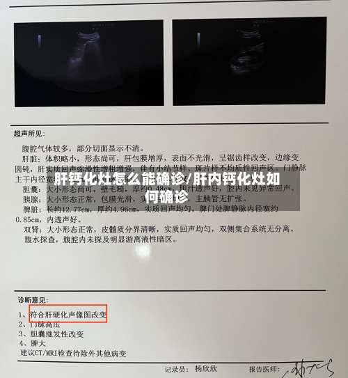 肝钙化灶怎么能确诊/肝内钙化灶如何确诊