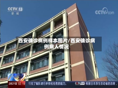 西安确诊病例样本图片/西安确诊病例病人情况-第2张图片