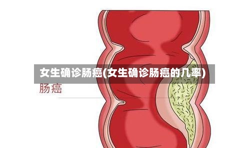 女生确诊肠癌(女生确诊肠癌的几率)