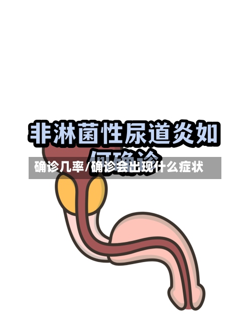 确诊几率/确诊会出现什么症状-第2张图片