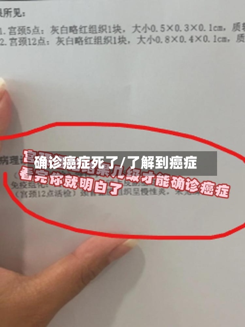 确诊癌症死了/了解到癌症