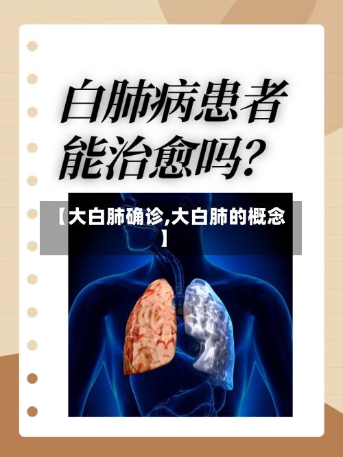 【大白肺确诊,大白肺的概念】-第3张图片