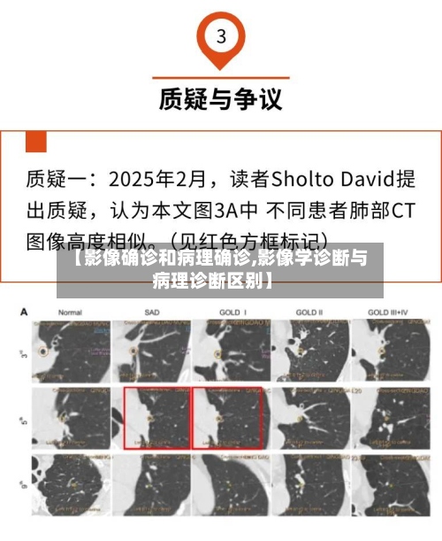 【影像确诊和病理确诊,影像学诊断与病理诊断区别】-第3张图片