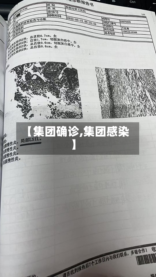 【集团确诊,集团感染】-第2张图片