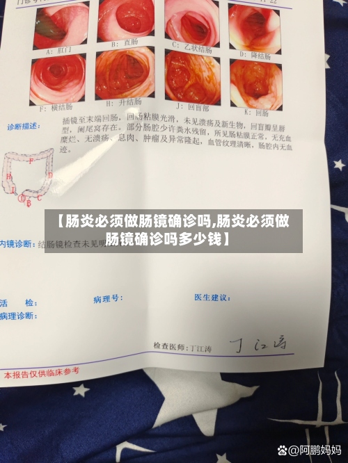 【肠炎必须做肠镜确诊吗,肠炎必须做肠镜确诊吗多少钱】-第3张图片