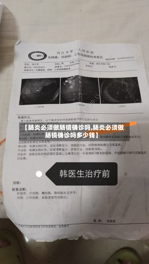 【肠炎必须做肠镜确诊吗,肠炎必须做肠镜确诊吗多少钱】-第2张图片