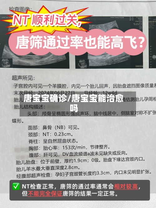 唐宝宝确诊/唐宝宝能治愈吗