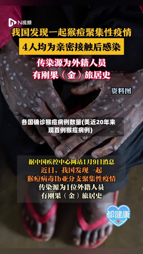 各国确诊猴痘病例数量(美近20年来现首例猴痘病例)-第2张图片