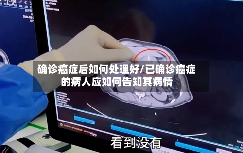 确诊癌症后如何处理好/已确诊癌症的病人应如何告知其病情-第2张图片