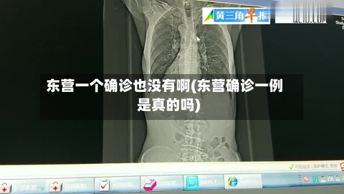 东营一个确诊也没有啊(东营确诊一例是真的吗)