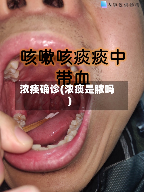 浓痰确诊(浓痰是脓吗)