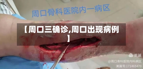 【周口三确诊,周口出现病例】-第2张图片