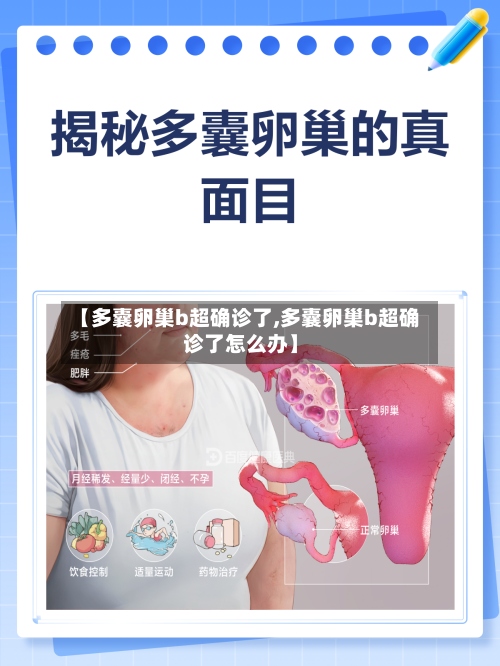 【多囊卵巢b超确诊了,多囊卵巢b超确诊了怎么办】