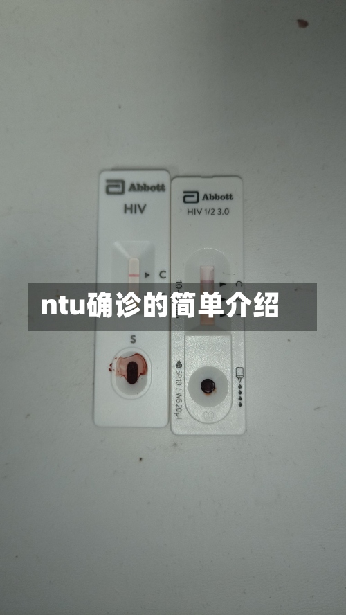 ntu确诊的简单介绍