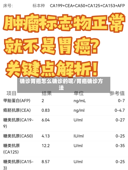 确诊胃癌怎么确诊的呢/胃癌确诊方法-第2张图片