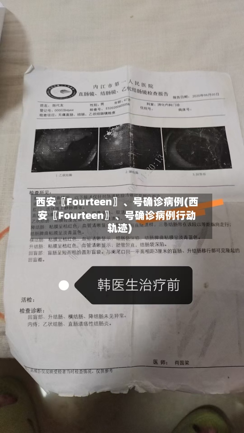 西安〖Fourteen〗、号确诊病例(西安〖Fourteen〗	、号确诊病例行动轨迹)-第3张图片