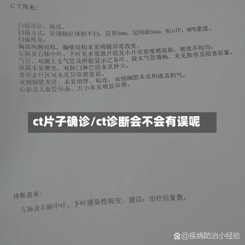 ct片子确诊/ct诊断会不会有误呢-第2张图片