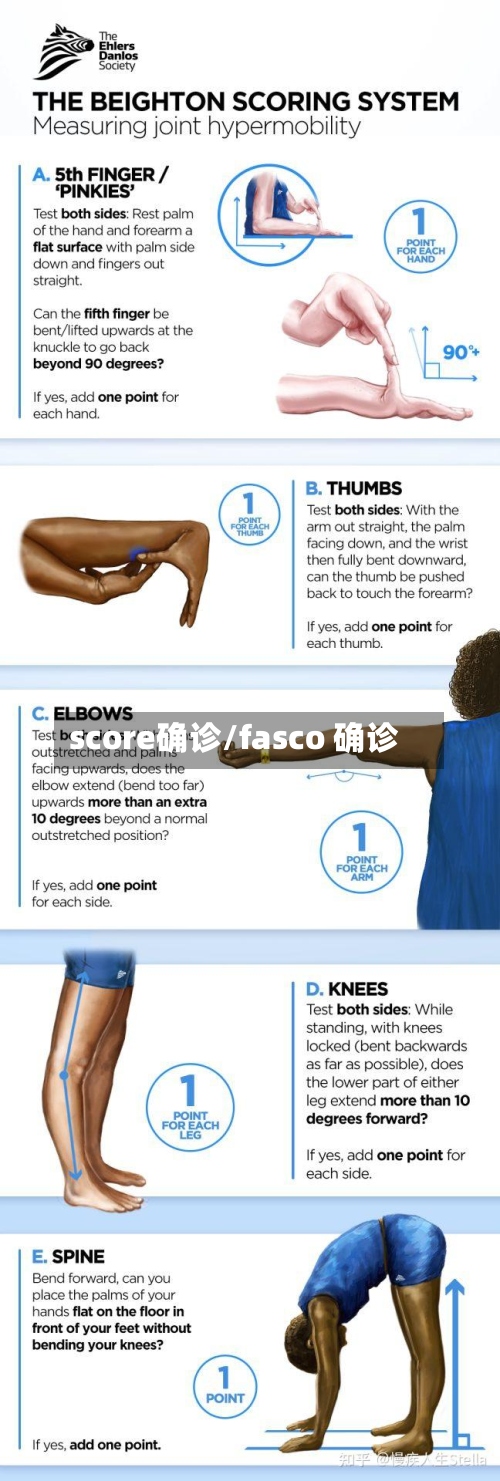 score确诊/fasco 确诊
