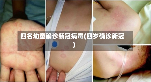 四名幼童确诊新冠病毒(四岁确诊新冠)-第3张图片