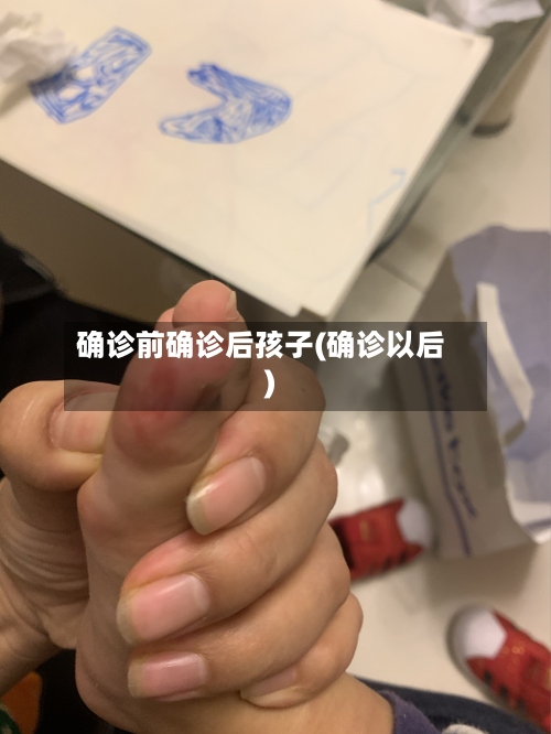 确诊前确诊后孩子(确诊以后)