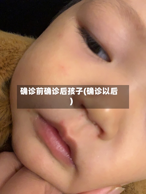 确诊前确诊后孩子(确诊以后)-第2张图片
