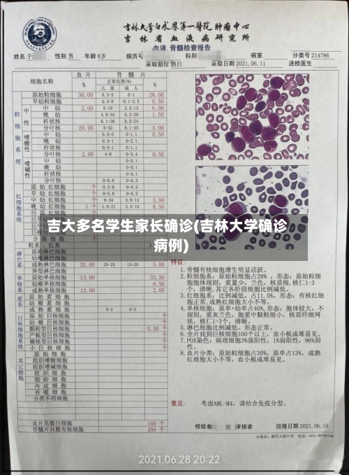吉大多名学生家长确诊(吉林大学确诊病例)-第2张图片