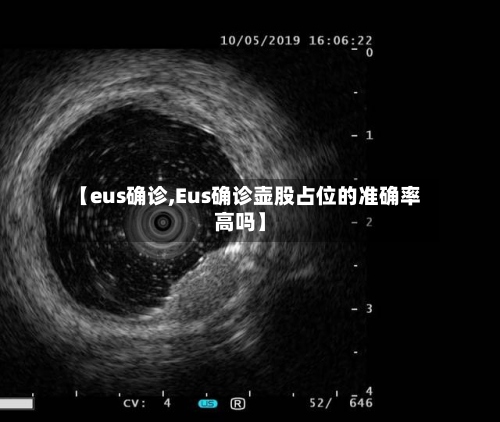 【eus确诊,Eus确诊壶股占位的准确率高吗】-第3张图片