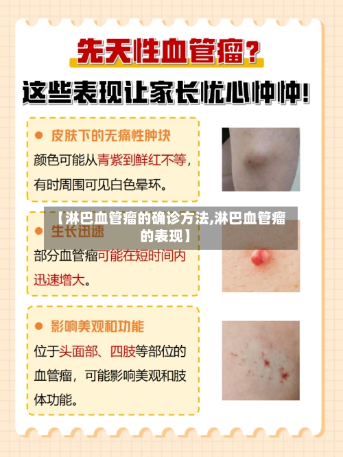 【淋巴血管瘤的确诊方法,淋巴血管瘤的表现】
