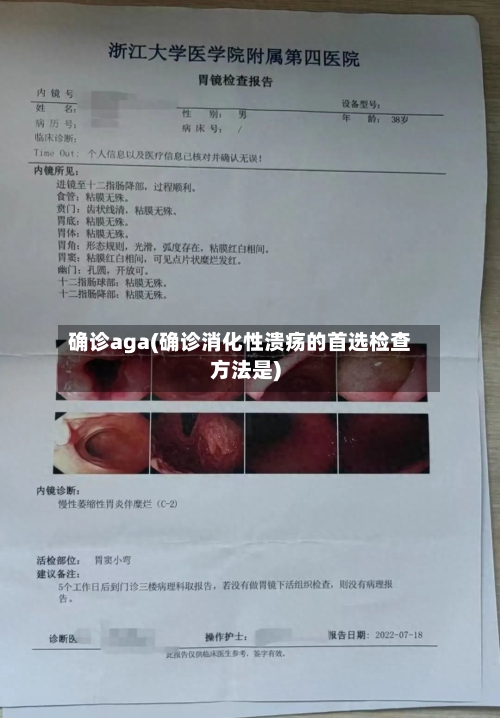 确诊aga(确诊消化性溃疡的首选检查方法是)-第2张图片