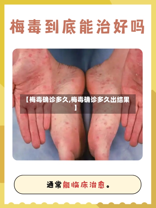 【梅毒确诊多久,梅毒确诊多久出结果】