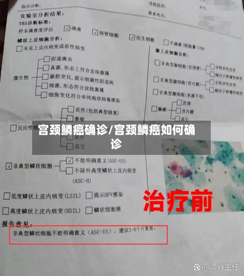 宫颈鳞癌确诊/宫颈鳞癌如何确诊