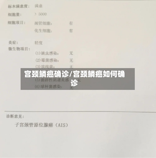 宫颈鳞癌确诊/宫颈鳞癌如何确诊-第2张图片