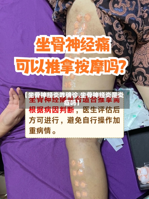 【坐骨神经炎咋确诊,坐骨神经炎是炎症吗】-第3张图片