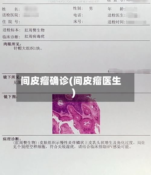 间皮瘤确诊(间皮瘤医生)-第2张图片