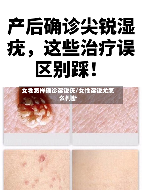 女牲怎样确诊湿锐疣/女性湿锐尤怎么判断