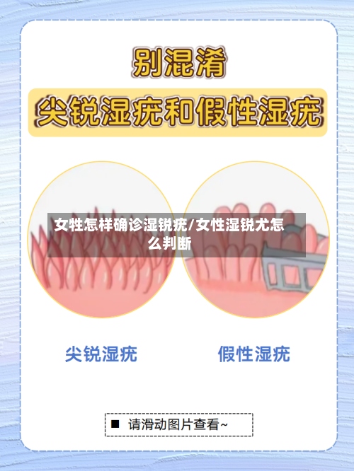 女牲怎样确诊湿锐疣/女性湿锐尤怎么判断-第2张图片